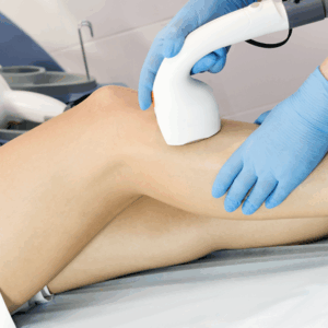 Laser Hair Removal Bundle - Large